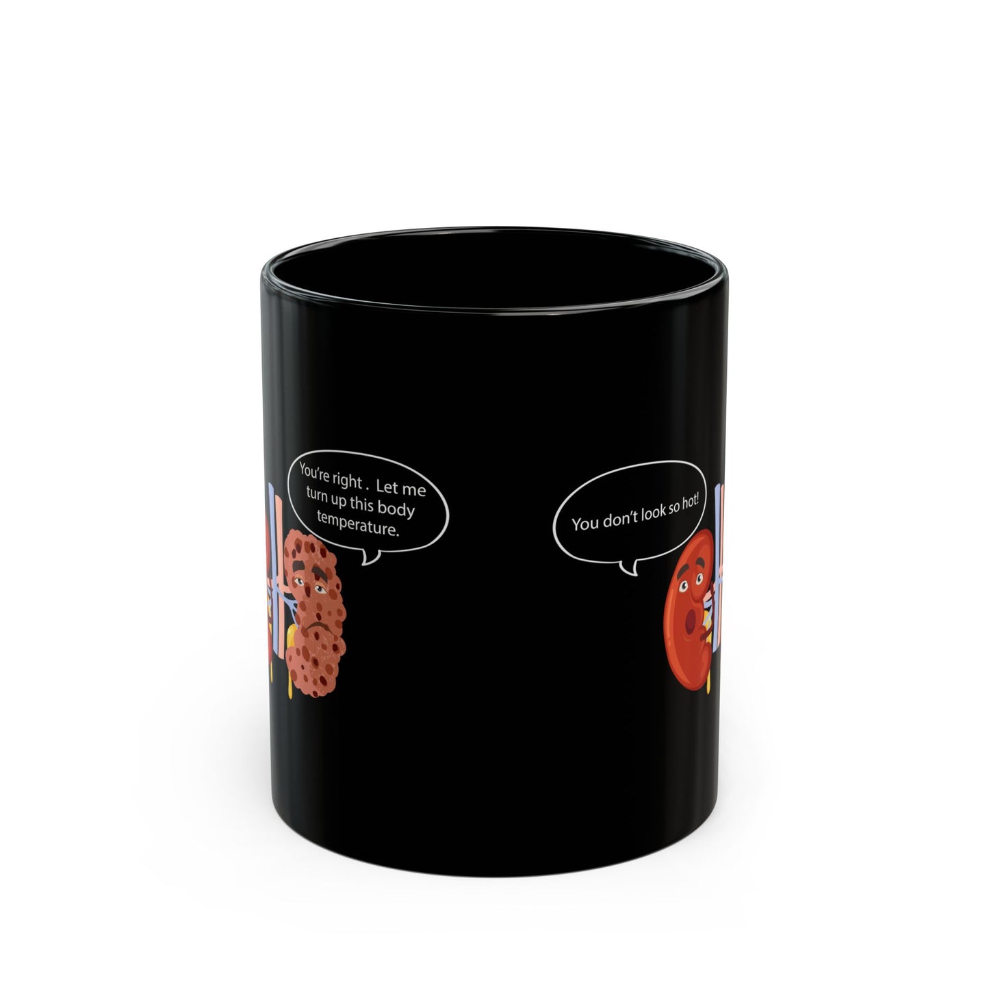 Funny Kidney Sponge Disease Awareness Mug - Black Ceramic (11oz, 15oz) - Urology & Nephrology Gift for Nurses, Doctors, Healthcare Professionals