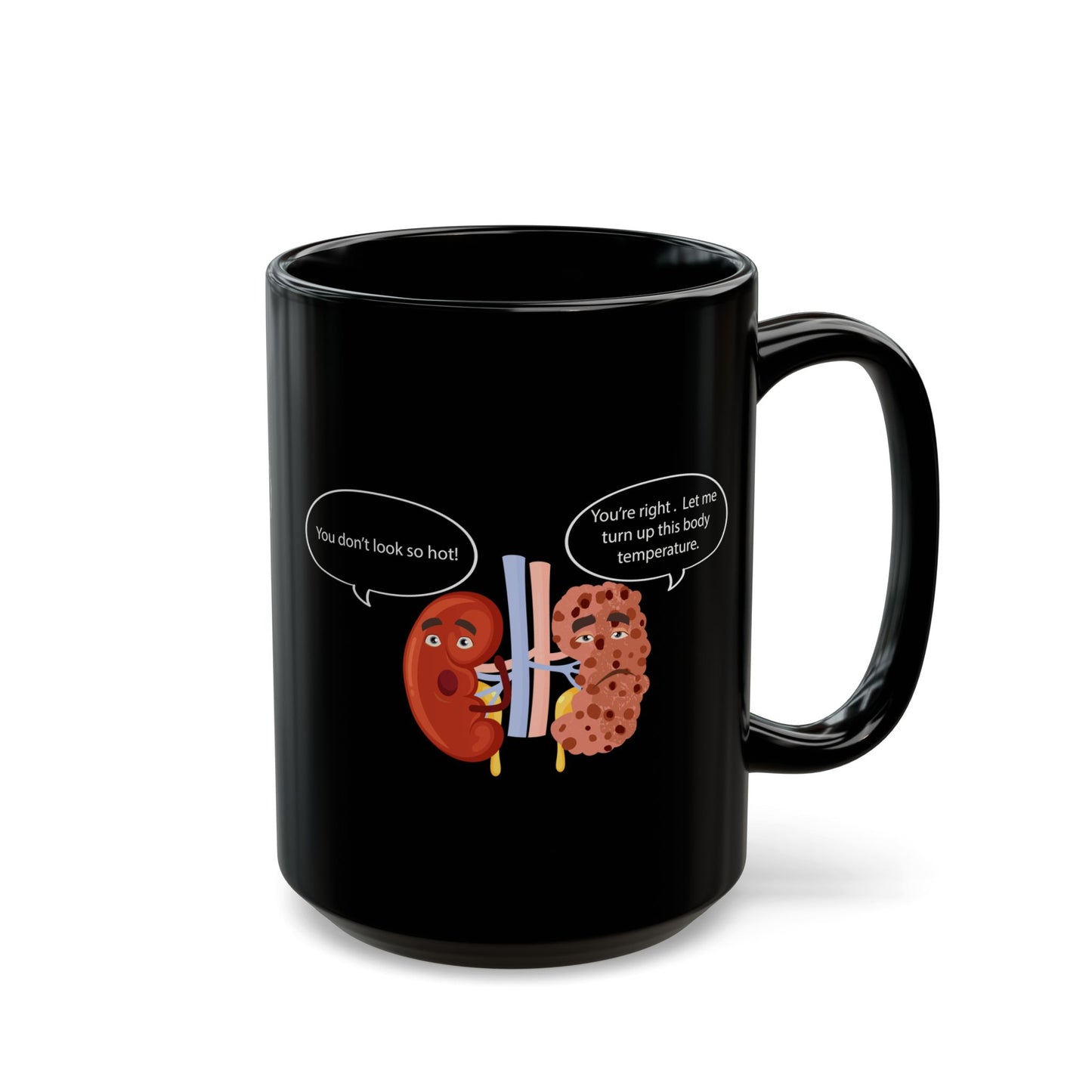 Funny Kidney Sponge Disease Awareness Mug - Black Ceramic (11oz, 15oz) - Urology & Nephrology Gift for Nurses, Doctors, Healthcare Professionals