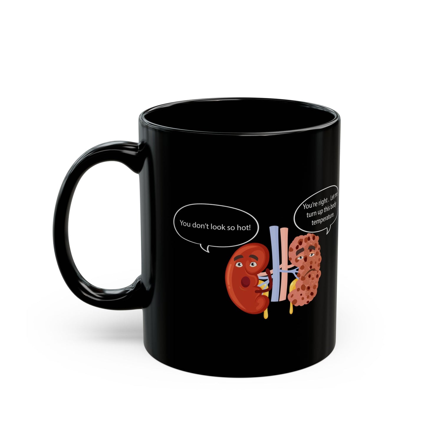 Funny Kidney Sponge Disease Awareness Mug - Black Ceramic (11oz, 15oz) - Urology & Nephrology Gift for Nurses, Doctors, Healthcare Professionals