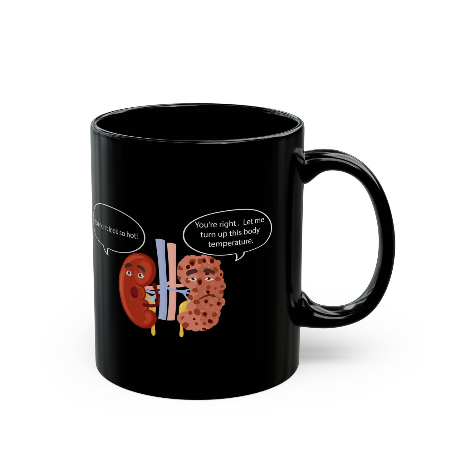 Funny Kidney Sponge Disease Awareness Mug - Black Ceramic (11oz, 15oz) - Urology & Nephrology Gift for Nurses, Doctors, Healthcare Professionals