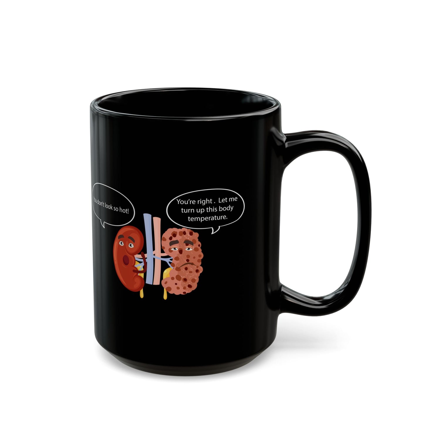 Funny Kidney Sponge Disease Awareness Mug - Black Ceramic (11oz, 15oz) - Urology & Nephrology Gift for Nurses, Doctors, Healthcare Professionals