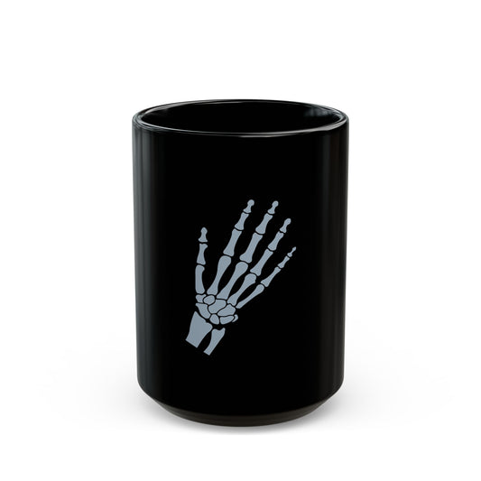 Human Hand Bones Black Mug (11oz, 15oz) - Medical